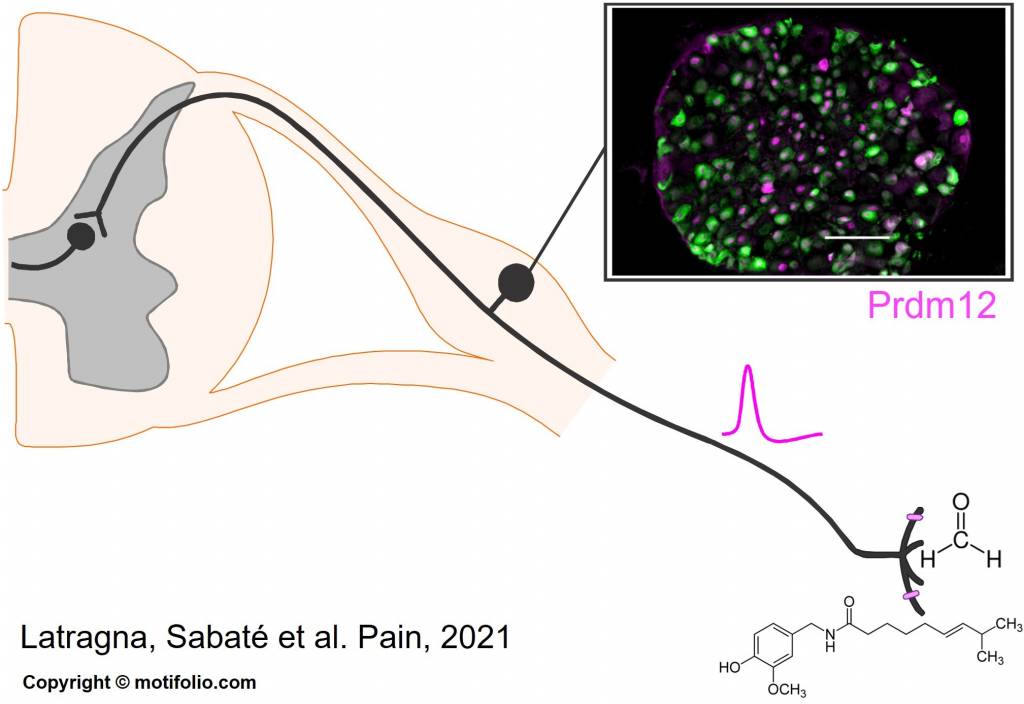 Le laboratoire de Neurosciences de l’UMONS, en collaboration avec l'ULB, identifie un gène utile pour le développement de nouveaux antidouleurs