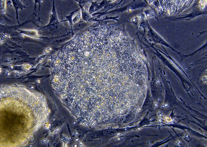 Un article de l'UMONS dans la revue « Nature Reviews Molecular Cell Biology » consacré aux déformations des noyaux cellulaires
