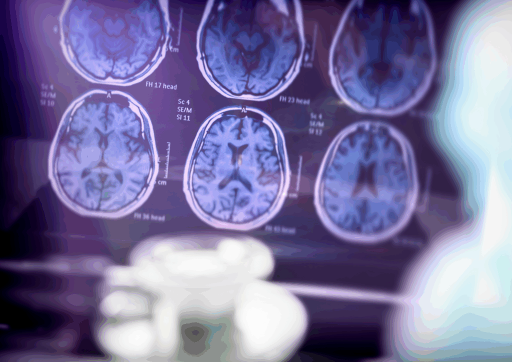 Le Fonds Alice Copette soutient une étude UMONS sur un espoir thérapeutique contre la maladie d’Alzheimer