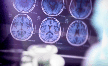 Le Fonds Alice Copette soutient une étude UMONS sur un espoir thérapeutique contre la maladie d’Alzheimer