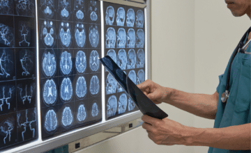 Troubles cognitifs et sclérose en plaques : l’IA au cœur d’une recherche entre l'UMONS et les CHU HELORA